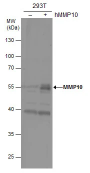 MMP10 antibody detects MMP10 protein by western blot analysis. Non-transfected (-) and MMP10-transfected (+) whole cell extracts (30 μg) were separated by 10% SDS-PAGE, and the membrane was blotted with MMP10 antibody (GTX103287) diluted at 1:1000.