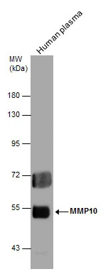 MMP10 antibody detects MMP10 protein by western blot analysis. Human tissue extracts (30 μg) was separated by 7.5% SDS-PAGE, and the membrane was blotted with MMP10 antibody (GTX103287) diluted at 1:2000.