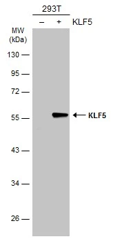 Non-transfected (–) and transfected (+) 293T whole cell extracts (30 μg) were separated by 10% SDS-PAGE, and the membrane was blotted with KLF5 antibody (GTX103289) diluted at 1:5000. The HRP-conjugated anti-rabbit IgG antibody (GTX213110-01) was used to detect the primary antibody.