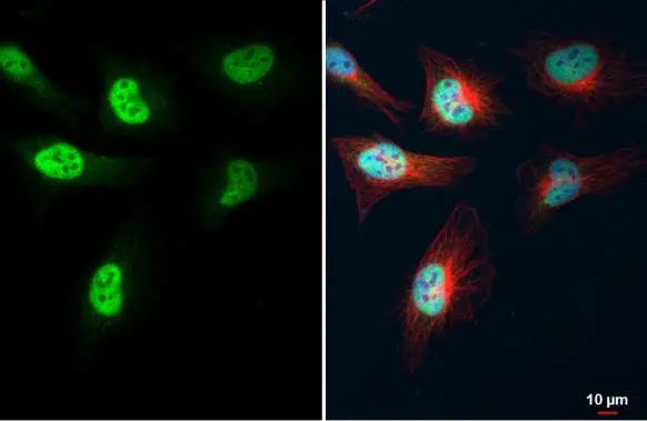 KLF5 antibody detects KLF5 protein at nucleus by immunofluorescent analysis. Sample: HeLa cells were fixed in 4% paraformaldehyde at RT for 15 min. Green: KLF5 stained by KLF5 antibody (GTX103289) diluted at 1:500. Red: alpha Tubulin, a cytoskeleton marker, stained by alpha Tubulin antibody [GT114] (GTX628802) diluted at 1:1000. Blue: Fluoroshield with DAPI (GTX30920).