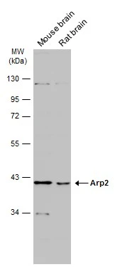 Various tissue extracts (50 μg) were separated by 10% SDS-PAGE, and the membrane was blotted with Arp2 antibody [N1C3] (GTX103311) diluted at 1:1000. The HRP-conjugated anti-rabbit IgG antibody (GTX213110-01) was used to detect the primary antibody.