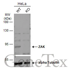 Wild-type (WT) and ZAK knockout (KO) HeLa cell extracts (30 μg) were separated by 7.5% SDS-PAGE, and the membrane was blotted with ZAK antibody [N3C2], Internal (GTX103317) diluted at 1:500. The HRP-conjugated anti-rabbit IgG antibody (GTX213110-01) was used to detect the primary antibody, and the signal was developed with Trident ECL plus-Enhanced.