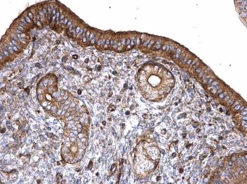 T-Plastin antibody detects T-Plastin protein at cytoplasm on mouse cervix by immunohistochemical analysis. Sample: Paraffin-embedded mouse cervix. T-Plastin antibody (GTX103323) diluted at 1:500. 
 Antigen Retrieval: Trilogy? (EDTA based, pH 8.0) buffer, 15min