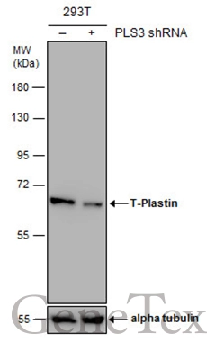 Non-transfected (–) and transfected (+) 293T whole cell extracts (30 μg) were separated by 7.5% SDS-PAGE, and the membrane was blotted with T-Plastin antibody (GTX103323) diluted at 1:4000. The HRP-conjugated anti-rabbit IgG antibody (GTX213110-01) was used to detect the primary antibody.