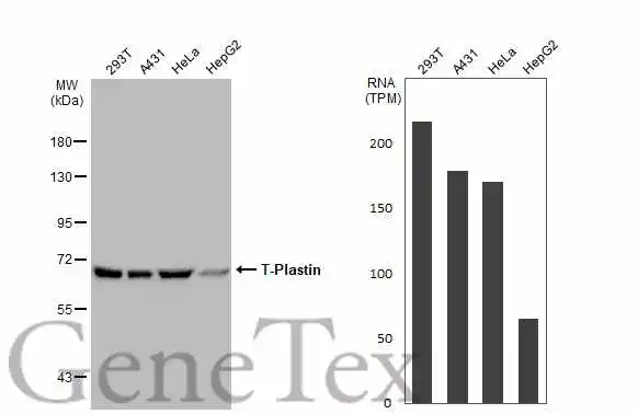 Various whole cell extracts (30 μg) were separated by 7.5% SDS-PAGE, and the membrane was blotted with T-Plastin antibody (GTX103323) diluted at 1:1000. The HRP-conjugated anti-rabbit IgG antibody (GTX213110-01) was used to detect the primary antibody. Corresponding RNA expression data for the same cell lines are based on Human Protein Atlas program.