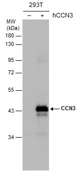 Non-transfected (–) and transfected (+) 293T whole cell extracts (30 μg) were separated by 10% SDS-PAGE, and the membrane was blotted with CCN3 antibody (GTX103377) diluted at 1:5000. The HRP-conjugated anti-rabbit IgG antibody (GTX213110-01) was used to detect the primary antibody.