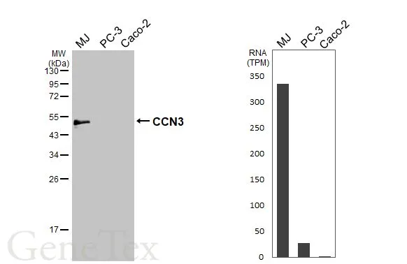 Various whole cell extracts (30 μg) were separated by 12% SDS-PAGE, and the membrane was blotted with CCN3 antibody (GTX103377) diluted at 1:1000. The HRP-conjugated anti-rabbit IgG antibody (GTX213110-01) was used to detect the primary antibody. Corresponding RNA expression data for the same cell lines are based on Human Protein Atlas program.