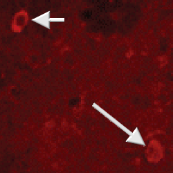 NPY staining?of striatal rat interneurones (arrows).