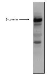 WB analysis of HCT116 cells using GTX10342 CTNNB1 antibody at 1:1000.