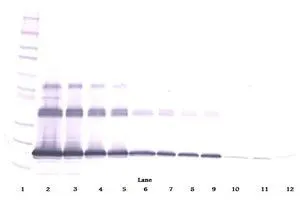 WB analysis of sequential diluted mouse RANKL recombinant protein under either reducing or non-reducing conditions using GTX10343 sRANKL antibody. Working concentration : 0.1 - 0.2 ug/ml