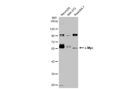 Various whole cell extracts (30 μg) were separated by 10% SDS-PAGE, and the membrane was blotted with c-Myc antibody (GTX103436) diluted at 1:1000. The HRP-conjugated anti-rabbit IgG antibody (GTX213110-01) was used to detect the primary antibody.