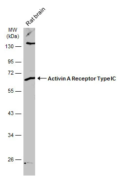 Rat tissue extract (50 μg) was separated by 10% SDS-PAGE, and the membrane was blotted with Activin A Receptor Type IC antibody (GTX103442) diluted at 1:500. The HRP-conjugated anti-rabbit IgG antibody (GTX213110-01) was used to detect the primary antibody.