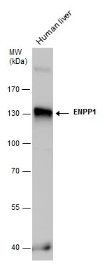 ENPP1 antibody detects ENPP1 protein by Western blot analysis. Human tissue extracts (30 μg) was separated by 7.5 % SDS-PAGE, and the membrane was blotted with ENPP1 antibody (GTX103447) at a dilution of 1:1000.
