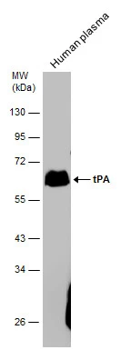 Human plasma (30 μg) was separated by 7.5% SDS-PAGE, and the membrane was blotted with tPA antibody (GTX103453) diluted at 1:2000.