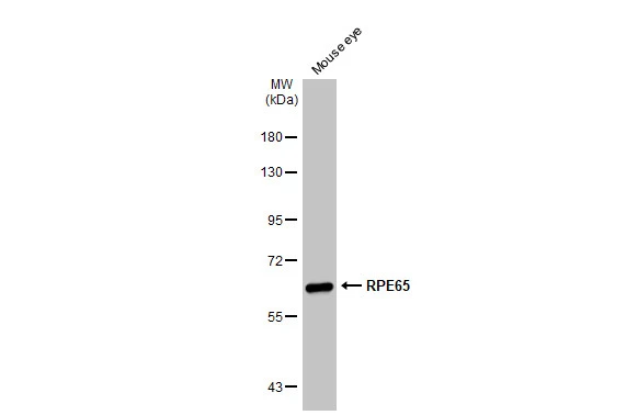 RPE65 antibody [N1C3]