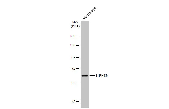 Mouse tissue extract (50 μg) was separated by 7.5% SDS-PAGE, and the membrane was blotted with RPE65 antibody [N1C3] (GTX103472) diluted at 1:1000. The HRP-conjugated anti-rabbit IgG antibody (GTX213110-01) was used to detect the primary antibody.