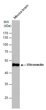 Vitronectin antibody detects Vitronectin protein by western blot analysis. Mouse tissue extracts (50 μg) was separated by 10% SDS-PAGE, and the membrane was blotted with Vitronectin antibody (GTX103475) diluted by 1:1000. The HRP-conjugated anti-rabbit IgG antibody (GTX213110-01) was used to detect the primary antibody.