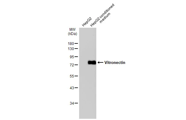 HepG2 whole cell extract and conditioned medium (30 μg) were separated by 10% SDS-PAGE, and the membrane was blotted with Vitronectin antibody (GTX103475) diluted at 1:1000. The HRP-conjugated anti-rabbit IgG antibody (GTX213110-01) was used to detect the primary antibody.