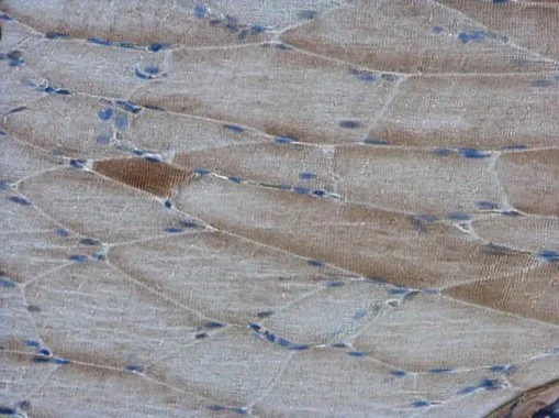 AMPK alpha 2 antibody detects AMPK alpha 2 protein at cytoplasm in rat muscle by immunohistochemical analysis. Sample: Paraffin-embedded rat muscle. AMPK alpha 2 antibody (GTX103487) diluted at 1:500. 
 Antigen Retrieval: Citrate buffer, pH 6.0, 15 min