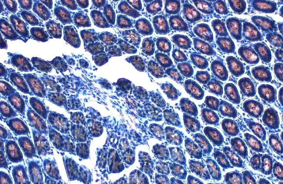 Ｘ様 atmos-adidas-zx-8000-mash-up-