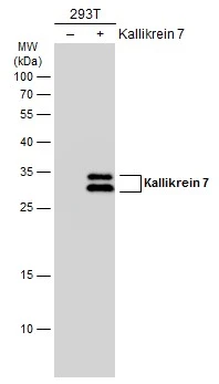 Non-transfected (–) and transfected (+) 293T whole cell extracts (30 μg) were separated by 12% SDS-PAGE, and the membrane was blotted with Kallikrein 7 antibody (GTX103548) diluted at 1:5000. The HRP-conjugated anti-rabbit IgG antibody (GTX213110-01) was used to detect the primary antibody.