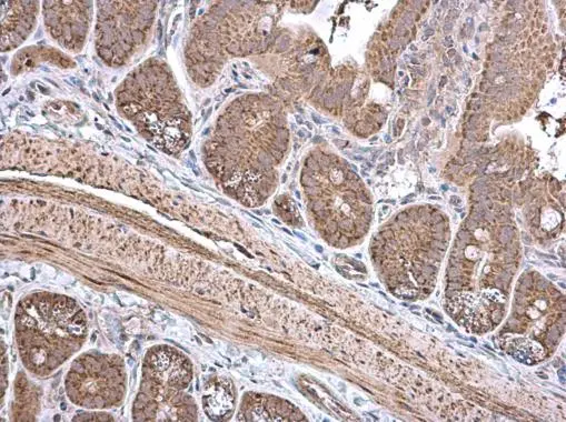 ECH1 antibody [N1C3] detects ECH1 protein at cytoplasm in mouse intestine by immunohistochemical analysis. Sample: Paraffin-embedded mouse intestine. ECH1 antibody [N1C3] (GTX103552) diluted at 1:500. 
 Antigen Retrieval: Citrate buffer, pH 6.0, 15 min