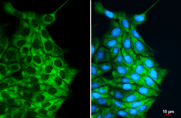 Desmin antibody detects Desmin protein at cytoplasm by immunofluorescent analysis. Sample: MDCK cells were fixed in 4% paraformaldehyde at RT for 15 min. Green: Desmin stained by Desmin antibody (GTX103557) diluted at 1:500.