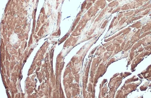 Desmin antibody detects Desmin protein at cytoplasm by immunohistochemical analysis. Sample: Paraffin-embedded mouse heart. Desmin stained by Desmin antibody (GTX103557) diluted at 1:500. Antigen Retrieval: Citrate buffer, pH 6.0, 15 min