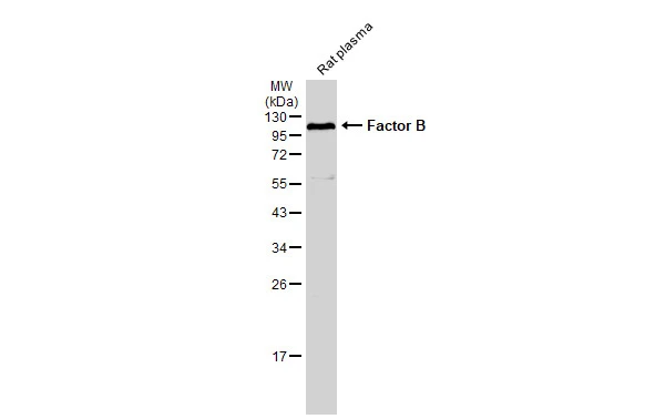 Rat plasma (50 μg) was separated by 12% SDS-PAGE, and the membrane was blotted with Factor B antibody [N2C2], Internal (GTX103570) diluted at 1:1000. The HRP-conjugated anti-rabbit IgG antibody (GTX213110-01) was used to detect the primary antibody.
