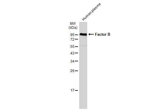 Human plasma (30 μg) was separated by 12% SDS-PAGE, and the membrane was blotted with Factor B antibody [N2C2], Internal (GTX103570) diluted at 1:1000. The HRP-conjugated anti-rabbit IgG antibody (GTX213110-01) was used to detect the primary antibody.
