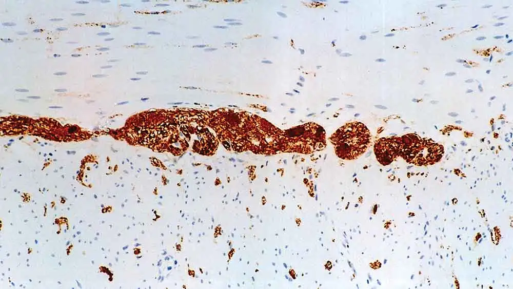 IHC-P analysis of human colon tissue using GTX10358 PGP9.5 antibody [10A1]. Note the staining in the neuronal elements and the ganglia of the longitudinal and circular smooth muscle.