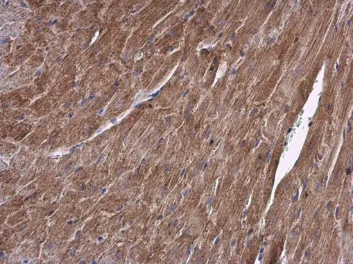 ALDH7A1 antibody detects ALDH7A1 protein at cytoplasm in mouse heart by immunohistochemical analysis. Sample: Paraffin-embedded mouse heart. ALDH7A1 antibody (GTX103593) diluted at 1:500.
Antigen Retrieval: Citrate buffer, pH 6.0, 15 min