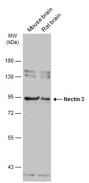 Various tissue extracts (50 μg) were separated by 7.5% SDS-PAGE, and the membrane was blotted with Nectin 3 antibody (GTX103654) diluted at 1:10000. The HRP-conjugated anti-rabbit IgG antibody (GTX213110-01) was used to detect the primary antibody.