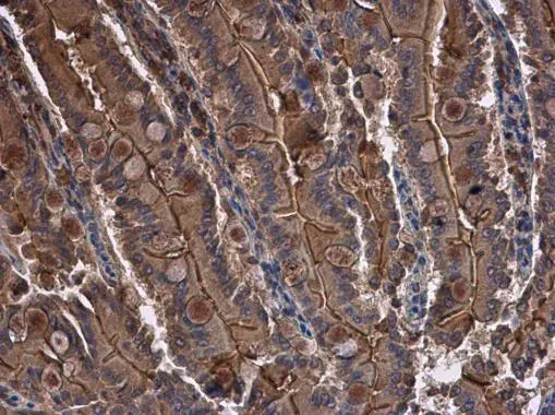 CYR61 antibody [N1C3] detects CYR61 protein at cytoplasm in rat intestine by immunohistochemical analysis. Sample: Paraffin-embedded rat intestine. CYR61 antibody [N1C3] (GTX103669) diluted at 1:500. 
 Antigen Retrieval: Citrate buffer, pH 6.0, 15 min