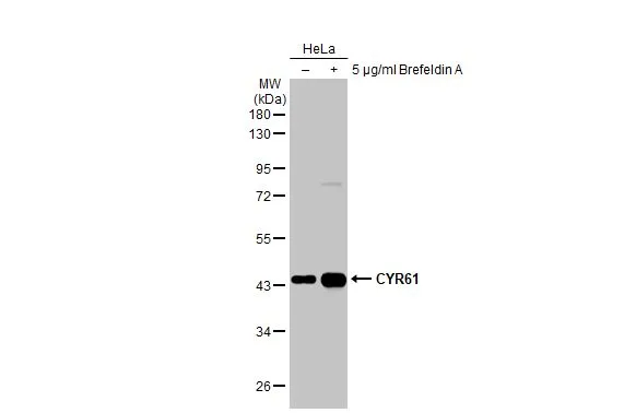 Untreated (–) and treated (+) HeLa whole cell extracts (30 μg) were separated by 10% SDS-PAGE, and the membrane was blotted with CYR61 antibody [N1C3] (GTX103669) diluted at 1:1000. The HRP-conjugated anti-rabbit IgG antibody (GTX213110-01) was used to detect the primary antibody.