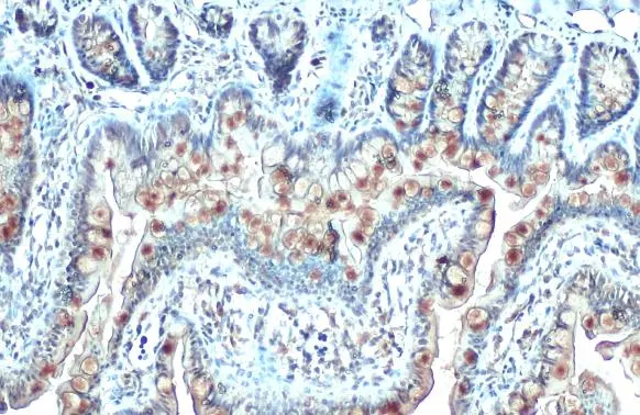 CYR61 antibody [N1C3] detects secreted CYR61 protein by immunohistochemical analysis. Sample: Paraffin-embedded rat colon. CYR61 stained by CYR61 antibody [N1C3] (GTX103669) diluted at 1:500. Antigen Retrieval: Citrate buffer, pH 6.0, 15 min