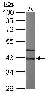 Sample (50 ug of whole cell lysate) A: Mouse brain 10% SDS PAGE GTX103676 diluted at 1:1000