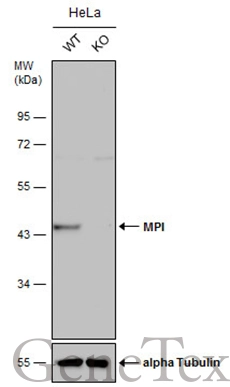 Wild-type (WT) and MPI knockout (KO) HeLa cell extracts (30 μg) were separated by 10% SDS-PAGE, and the membrane was blotted with MPI antibody (GTX103682) diluted at 1:500. The HRP-conjugated anti-rabbit IgG antibody (GTX213110-01) was used to detect the primary antibody.