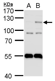 HIF2 alpha antibody detects HIF2 alpha protein by western blot analysis.