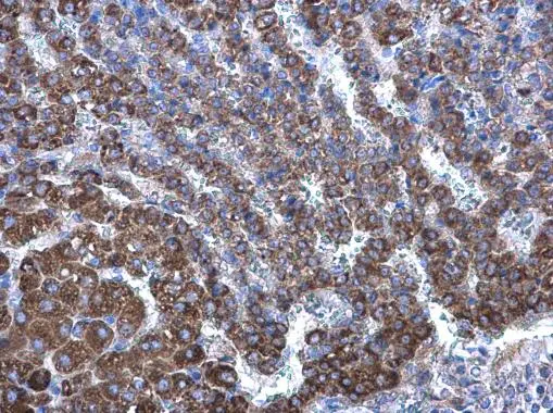 Seladin 1 antibody [N1C2] detects Seladin 1 protein at cytoplasm on rat adrenal gland by immunohistochemical analysis. Sample: Paraffin-embedded rat adrenal gland. Seladin 1 antibody [N1C2] (GTX103712) diluted at 1:500. 
 Antigen Retrieval: Trilogy? (EDTA based, pH 8.0) buffer, 15min