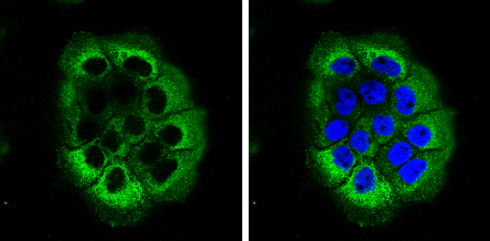 Laminin beta 3 antibody [C1C2], Internal detects Laminin beta 3 protein by immunofluorescent analysis. Sample: A431 cells were fixed in 4% paraformaldehyde at RT for 15 min. Green: Laminin beta 3 stained by Laminin beta 3 antibody [C1C2], Internal (GTX103736) diluted at 1:500. Blue: Hoechst 33342 staining.