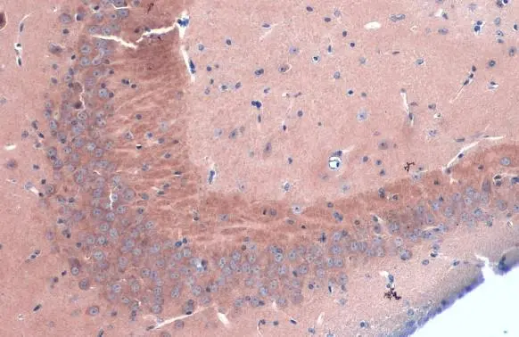 BACE1 antibody [N1C2] detects BACE1 protein at cytoplasm by immunohistochemical analysis. Sample: Paraffin-embedded mouse hippocampus. BACE1 stained by BACE1 antibody [N1C2] (GTX103757) diluted at 1:1000. Antigen Retrieval: Citrate buffer, pH 6.0, 15 min