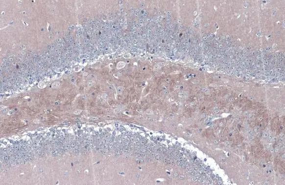 BACE1 antibody [N1C2] detects BACE1 protein at cytoplasm by immunohistochemical analysis. Sample: Paraffin-embedded mouse hippocampus. BACE1 stained by BACE1 antibody [N1C2] (GTX103757) diluted at 1:500. Antigen Retrieval: Citrate buffer, pH 6.0, 15 min