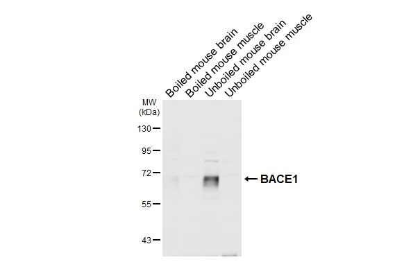 Boiled and unboiled various tissue extracts (50 μg) were separated by 7.5% SDS-PAGE, and the membrane was blotted with BACE1 antibody [N1C2] (GTX103757) diluted at 1:1000. The HRP-conjugated anti-rabbit IgG antibody (GTX213110-01) was used to detect the primary antibody.