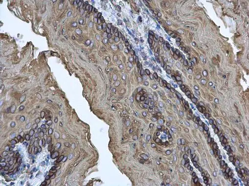 Cytokeratin 17 antibody detects Cytokeratin 17 protein at cytoplasm on mouse esophagus by immunohistochemical analysis. Sample: Paraffin-embedded mouse esophagus. Cytokeratin 17 antibody (GTX103765) diluted at 1:500.
Antigen Retrieval: Trilogy? (EDTA based, pH 8.0) buffer, 15min Cytokeratin 17 antibody detects Cytokeratin 17 protein at cytoplasm on mouse esophagus by immunohistochemical analysis. Sample: Paraffin-embedded mouse esophagus. Cytokeratin 17 antibody (GTX103765) diluted at 1:500.
Antigen Retrieval: Trilogy? (EDTA based, pH 8.0) buffer, 15min