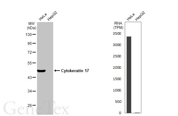 Various whole cell extracts (30 μg) were separated by 10% SDS-PAGE, and the membrane was blotted with Cytokeratin 17 (GTX103765) diluted at 1:5000. The HRP-conjugated anti-rabbit IgG antibody (GTX213110-01) was used to detect the primary antibody. Corresponding RNA expression data for the same cell lines are based on Human Protein Atlas program. Various whole cell extracts (30 μg) were separated by 10% SDS-PAGE, and the membrane was blotted with Cytokeratin 17 (GTX103765) diluted at 1:5000. The HRP-conjugated anti-rabbit IgG antibody (GTX213110-01) was used to detect the primary antibody. Corresponding RNA expression data for the same cell lines are based on Human Protein Atlas program.