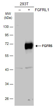 Non-transfected (–) and transfected (+) 293T whole cell extracts (30 μg) were separated by 10% SDS-PAGE, and the membrane was blotted with FGFR5 antibody (GTX103778) diluted at 1:1000. The HRP-conjugated anti-rabbit IgG antibody (GTX213110-01) was used to detect the primary antibody.