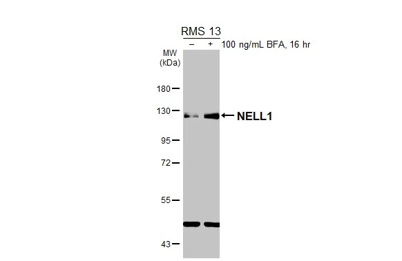 Untreated (–) and treated (+) RMS 13 whole cell extracts (30 μg) were separated by 7.5% SDS-PAGE, and the membrane was blotted with NELL1 antibody (GTX103819) diluted at 1:1000. The HRP-conjugated anti-rabbit IgG antibody (GTX213110-01) was used to detect the primary antibody.