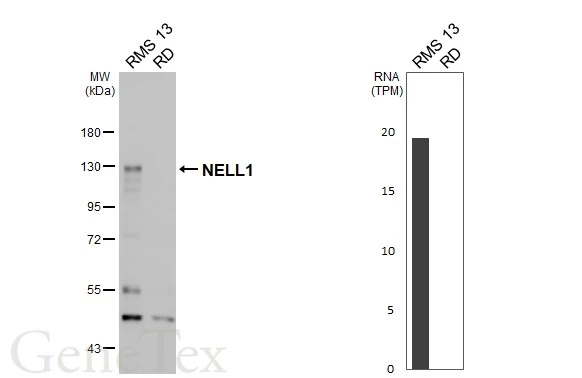 Various whole cell extracts (30 μg) were separated by 7.5% SDS-PAGE, and the membrane was blotted with NELL1 antibody (GTX103819) diluted at 1:1000. The HRP-conjugated anti-rabbit IgG antibody (GTX213110-01) was used to detect the primary antibody, and the signal was developed with Trident ECL plus-Enhanced. Corresponding RNA expression data are based on Human Protein Atlas program.