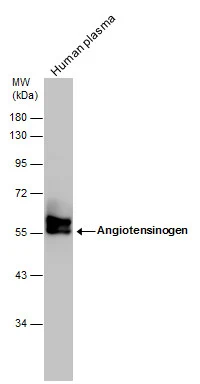Human tissue extract (30 μg) was separated by 10% SDS-PAGE, and the membrane was blotted with Angiotensinogen antibody [N1C3] (GTX103824) diluted at 1:500. The HRP-conjugated anti-rabbit IgG antibody (GTX213110-01) was used to detect the primary antibody.